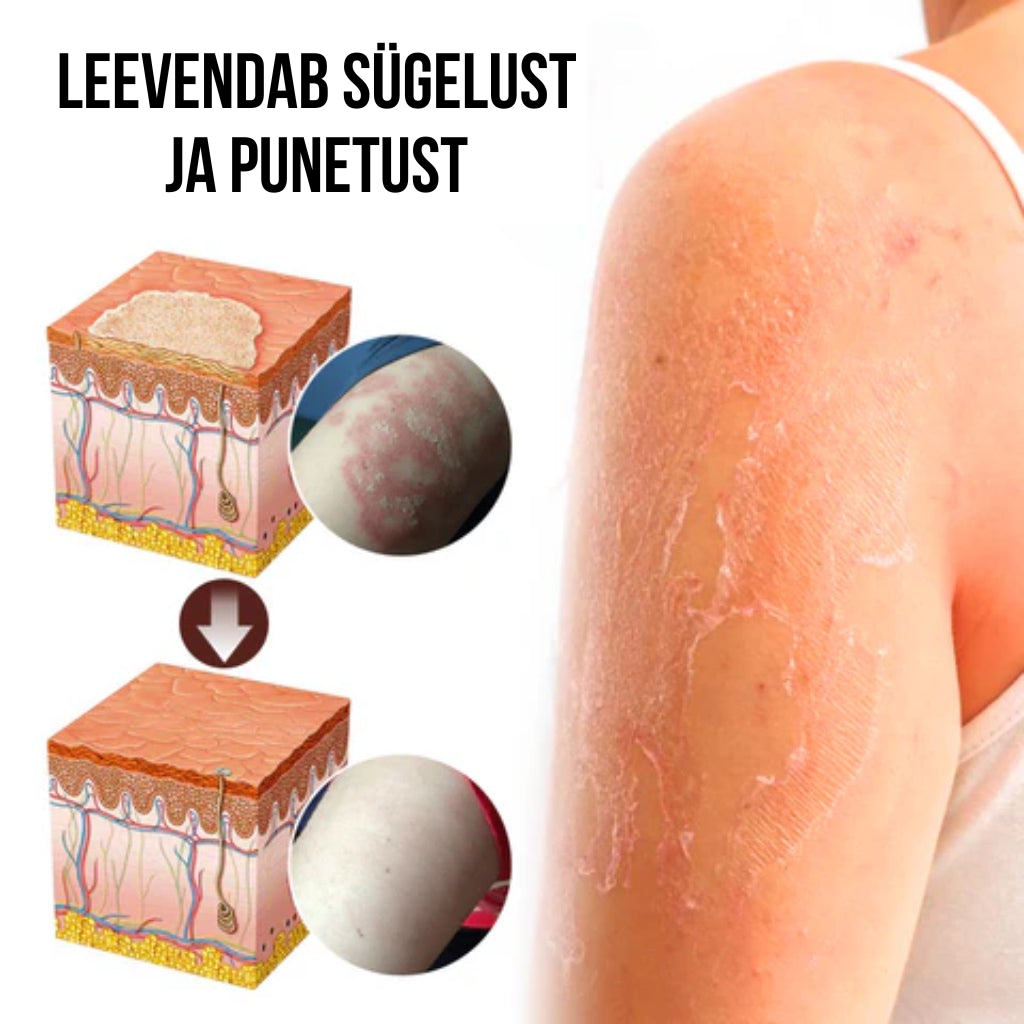 Lehmapiima seerum kõikidele nahaprobleemidele