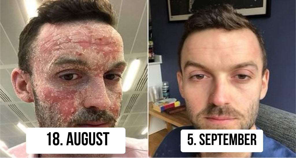 Naha taaselustav seep