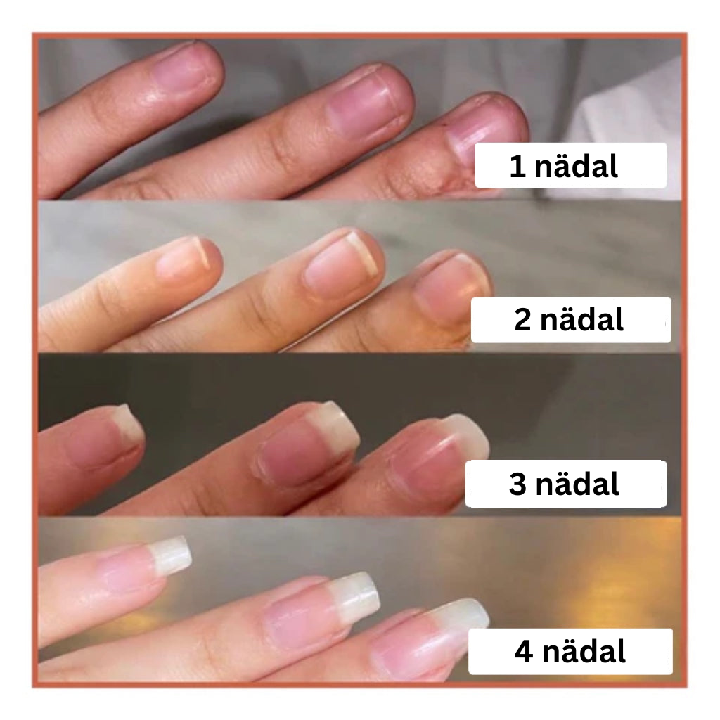 Küünte kasvu ja tugevdamise seerum