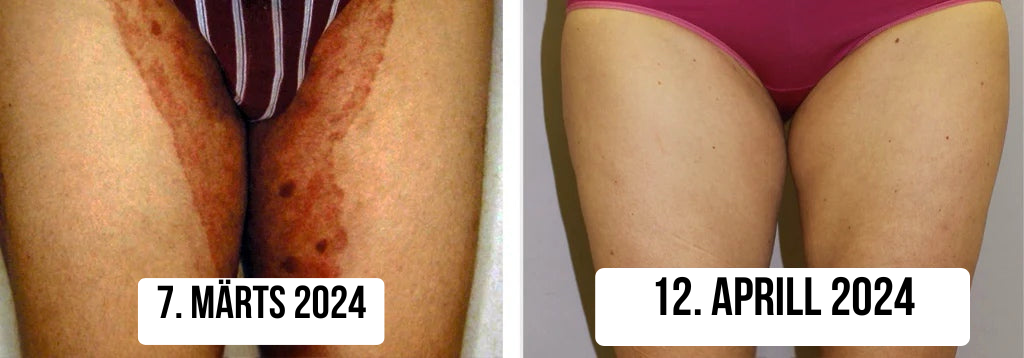 Naha taaselustav kreem