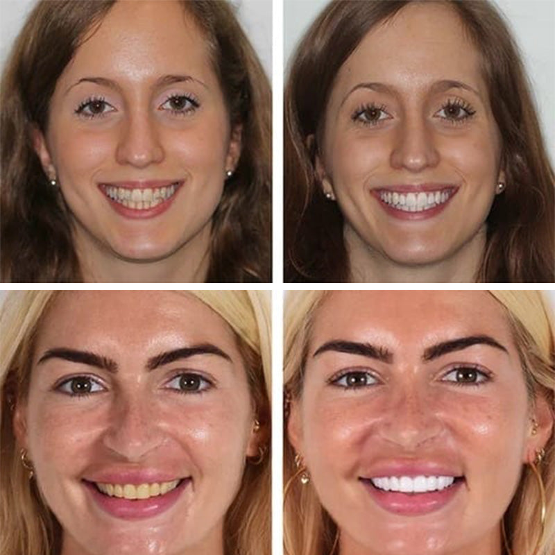 Valgendav ja igemeid tugevdav hambapasta