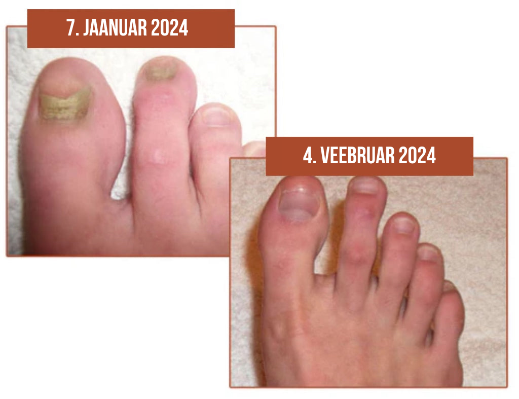 Küünte kasvu ja tugevdamise seerum