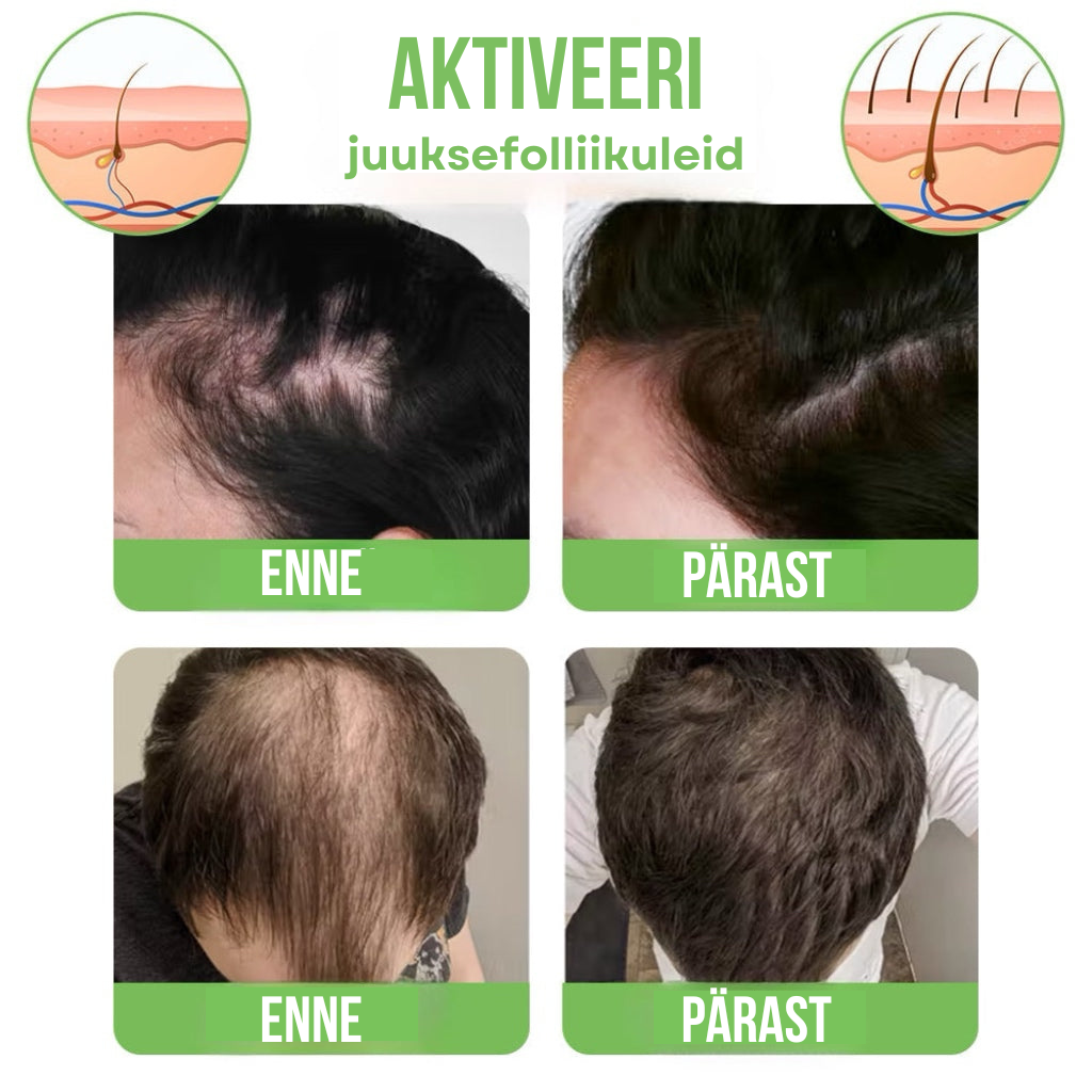 Sprei juuste kasvu ingveri ekstraktiga