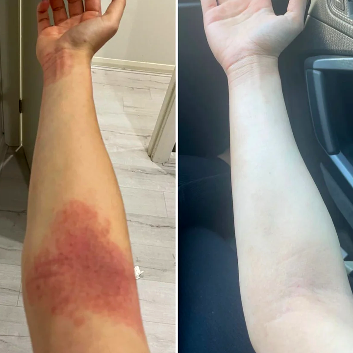 Lehmapiima seerum kõikidele nahaprobleemidele