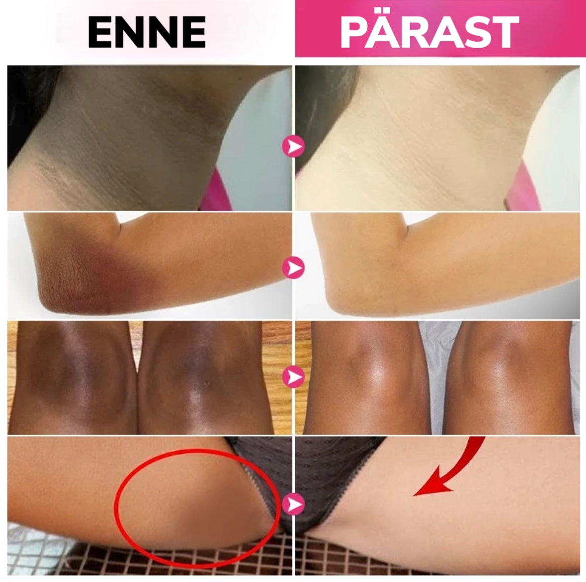 Naha valgendav kreem