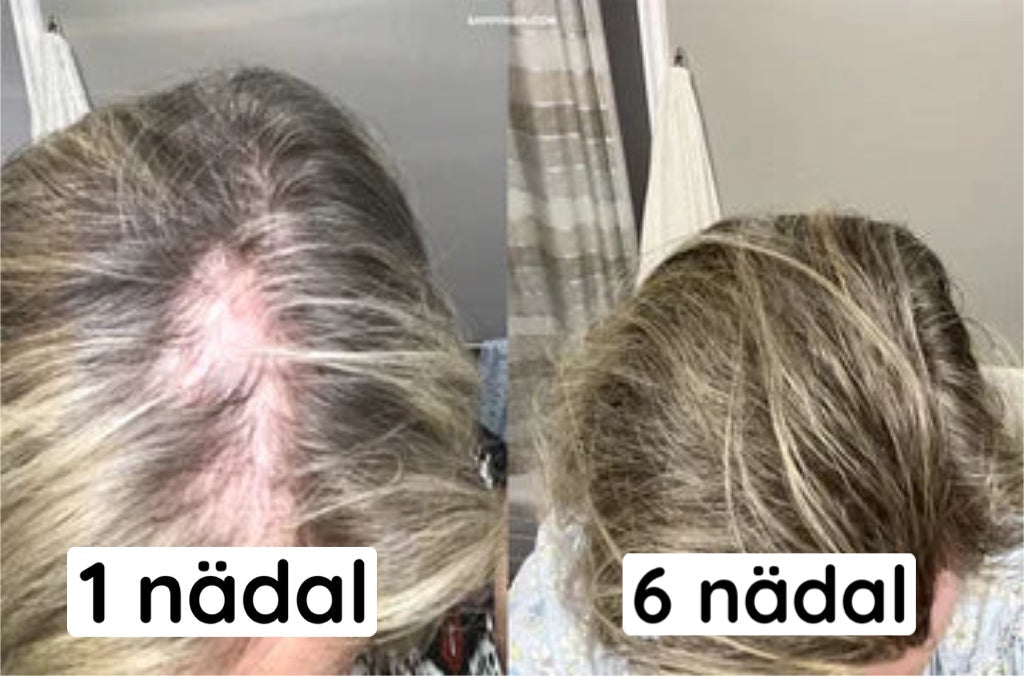 Looduslik eeterlik õli juustele