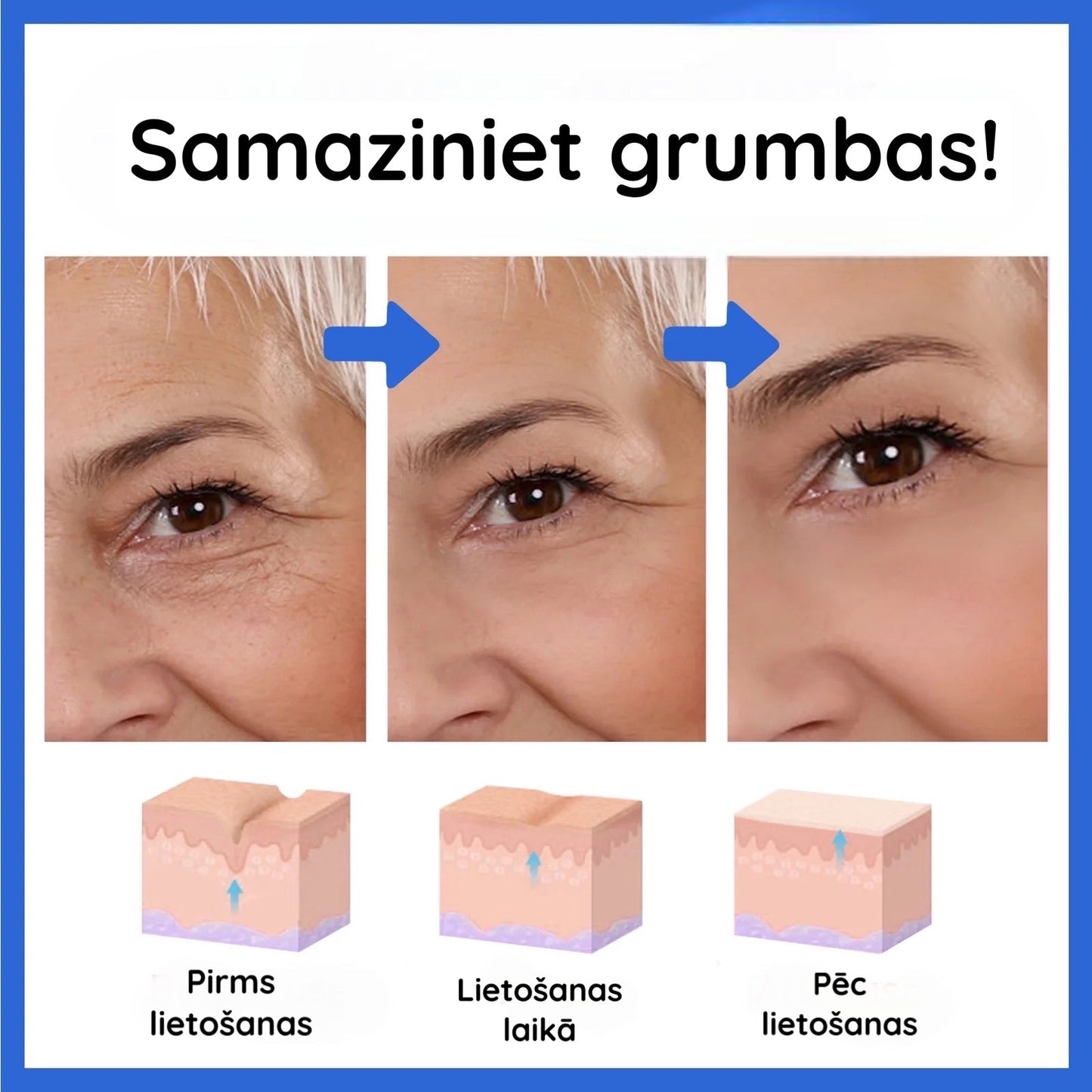 Botox näoseerum