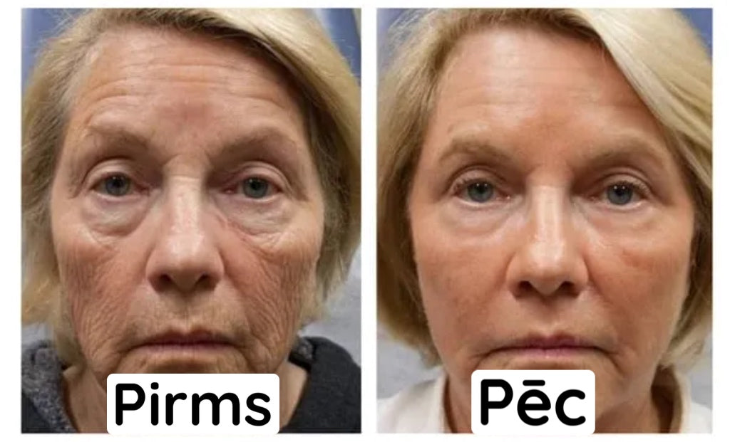 Botox näoseerum