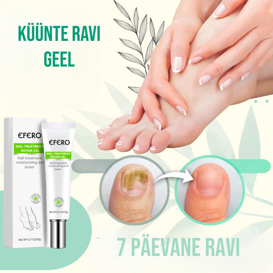 Küünte parandamise geel