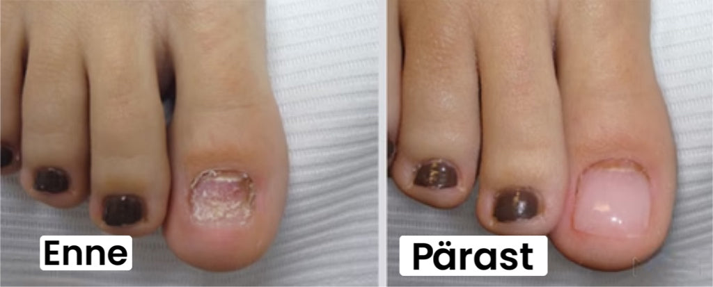 Küünte parandamise geel