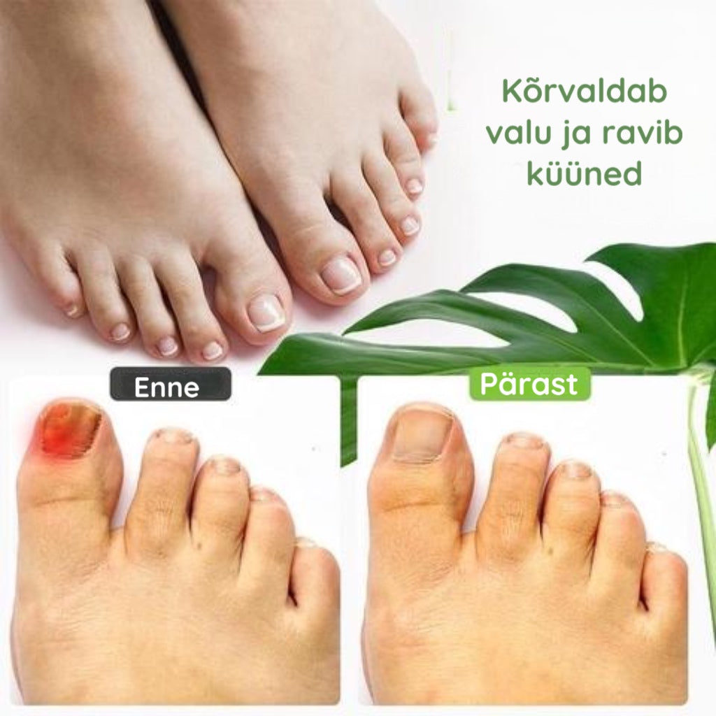 Seenevastane küünte geel