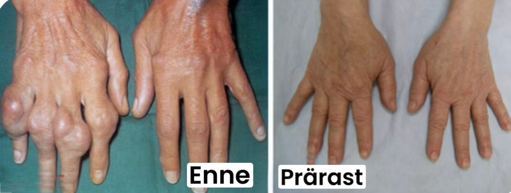 Geel-pamlsa mesilasmürgiga