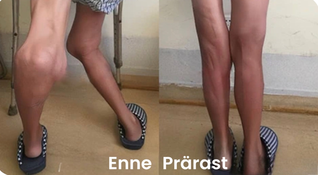 Geel-pamlsa mesilasmürgiga