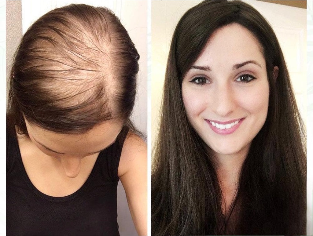 Orgaaniline juuste seerum