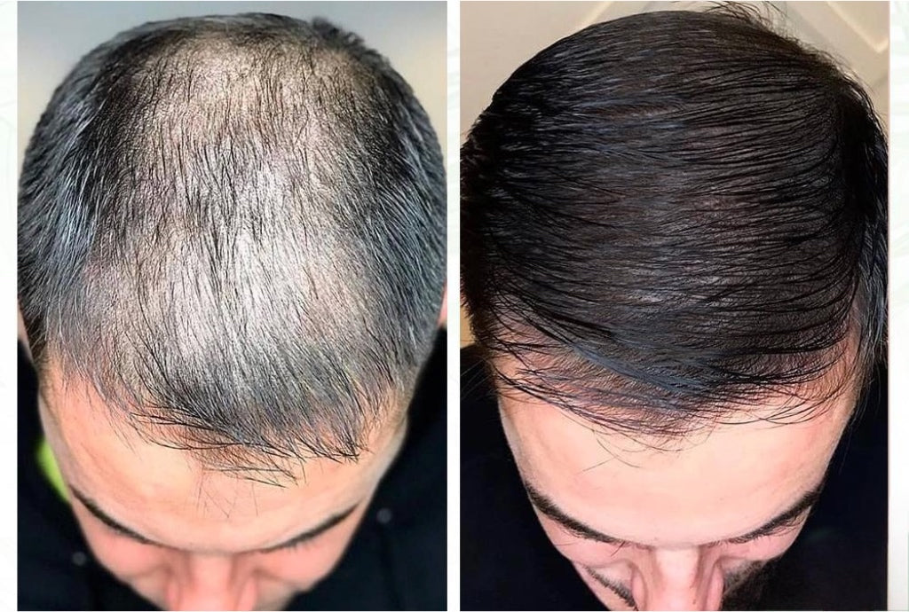 Orgaaniline juuste seerum