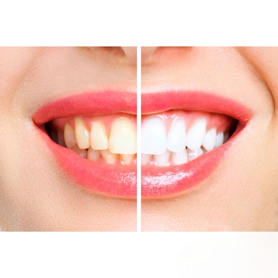 OralTech Pro | Tuleviku tehnoloogia suuhügieeniks