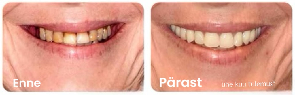 "Smile" hammaste valgendamisvedelik