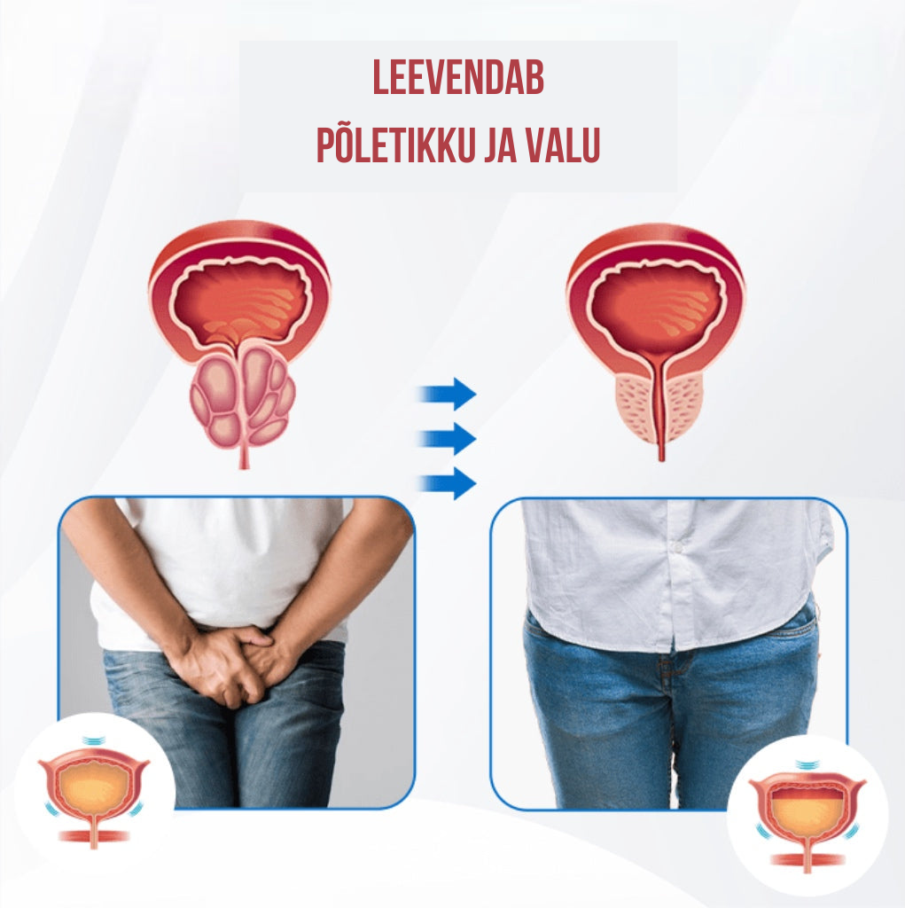 Magnetiline vask käevõru tervisele