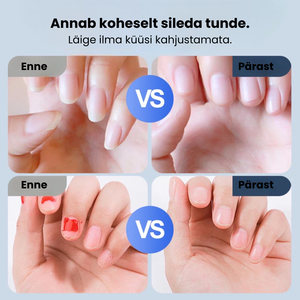 Universaalne automaatne küüneviil täiskasvanutele ja lastele