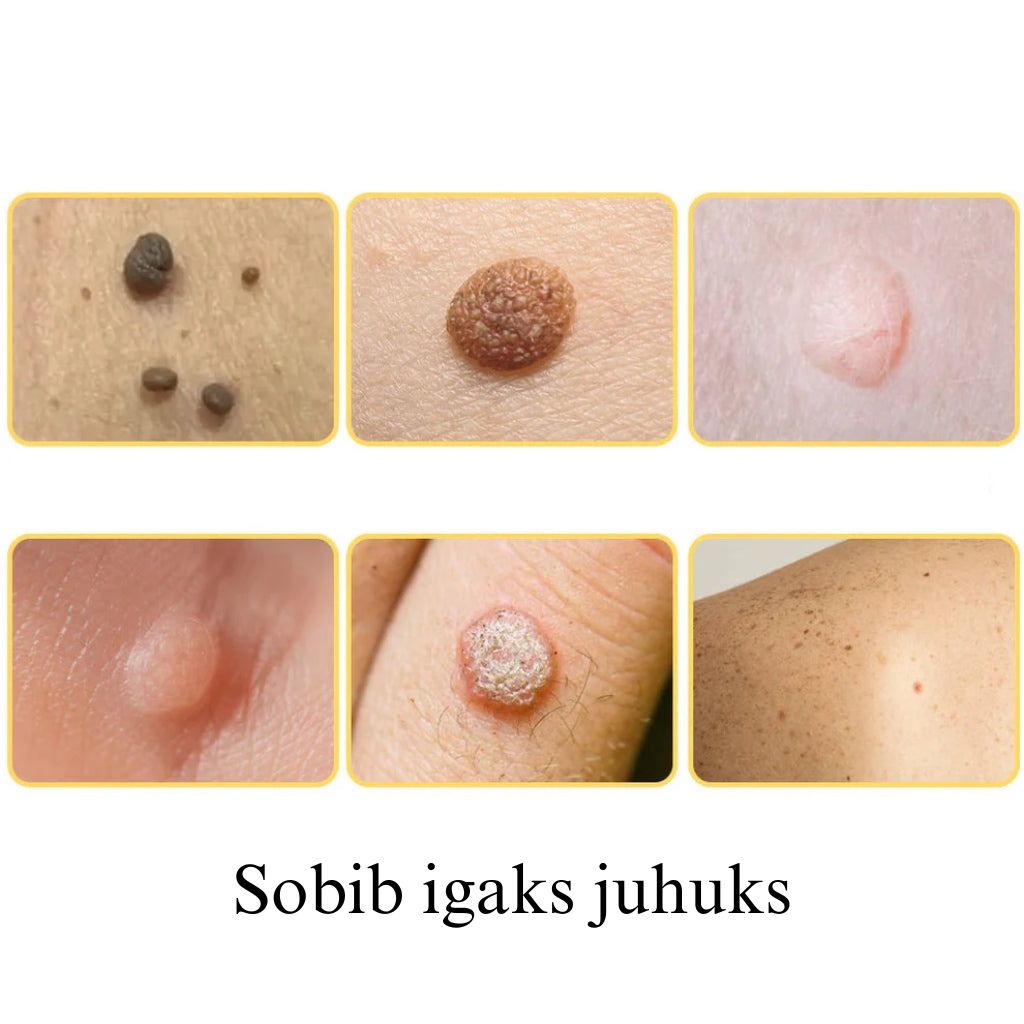 Mesilasmürk tervendav sprei