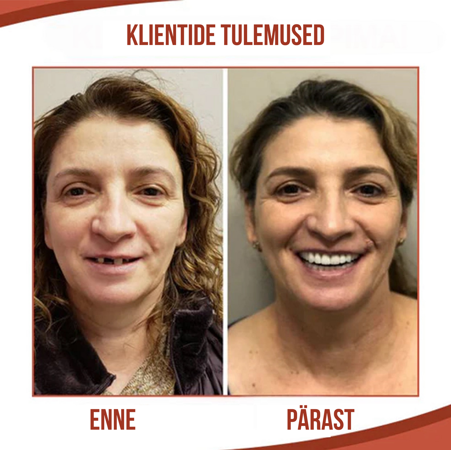 Silikoonist proteesid