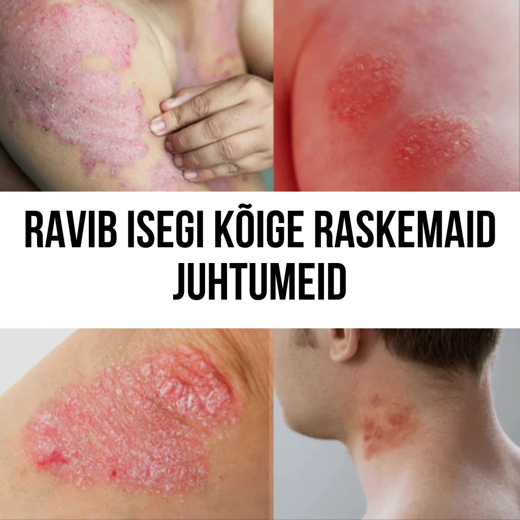 Lehmapiima seerum kõikidele nahaprobleemidele