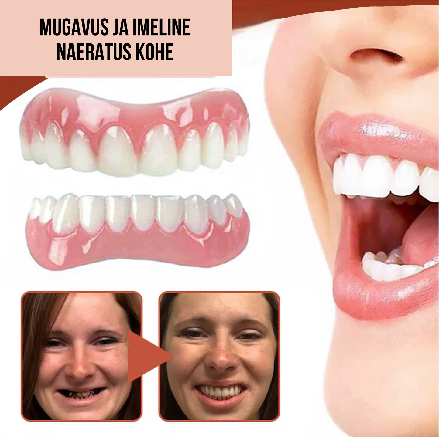 Silikoonist proteesid