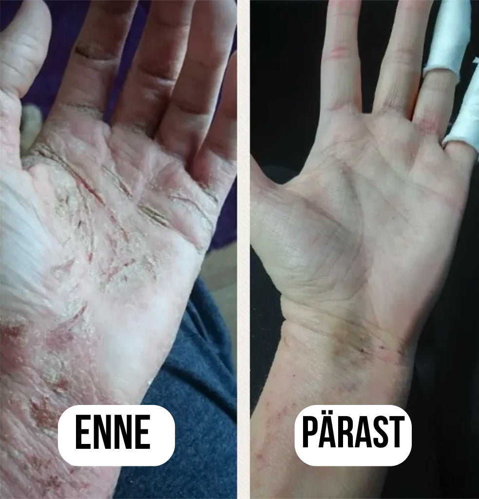 Lehmapiima seerum kõikidele nahaprobleemidele