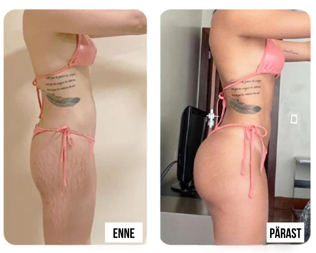 Täiustatud pinguldav ja kortse vähendav kreem